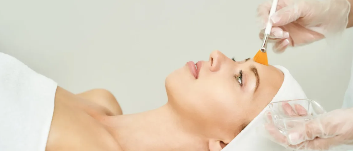 Glycolic Acid Peel (AHA)